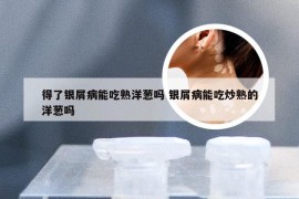 得了银屑病能吃熟洋葱吗 银屑病能吃炒熟的洋葱吗