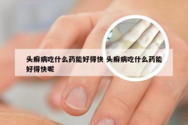 头癣病吃什么药能好得快 头癣病吃什么药能好得快呢