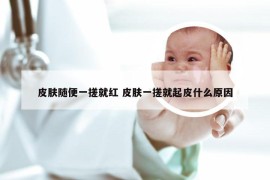 皮肤随便一搓就红 皮肤一搓就起皮什么原因