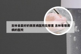 吉林省最好的银屑病医院在那里 吉林看银屑病的医院