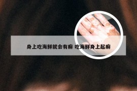 身上吃海鲜就会有癣 吃海鲜身上起癣