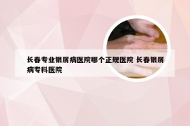 长春专业银屑病医院哪个正规医院 长春银屑病专科医院