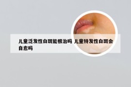 儿童泛发性白斑能根治吗 儿童特发性白斑会自愈吗