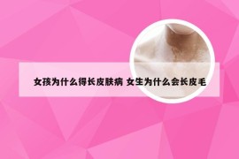 女孩为什么得长皮肤病 女生为什么会长皮毛