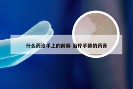 什么药治手上的前癣 治疗手藓的药膏