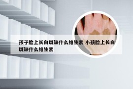 孩子脸上长白斑缺什么维生素 小孩脸上长白斑缺什么维生素