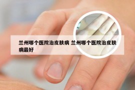 兰州哪个医院治皮肤病 兰州哪个医院治皮肤病最好