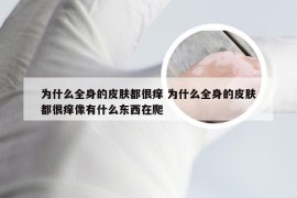 为什么全身的皮肤都很痒 为什么全身的皮肤都很痒像有什么东西在爬