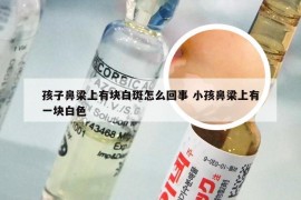 孩子鼻梁上有块白斑怎么回事 小孩鼻梁上有一块白色