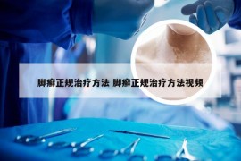 脚癣正规治疗方法 脚癣正规治疗方法视频