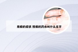 用癣的症状 擦癣的药水叫什么名字