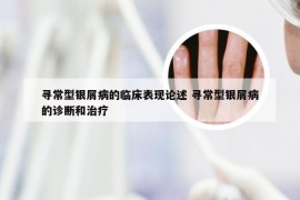 寻常型银屑病的临床表现论述 寻常型银屑病的诊断和治疗