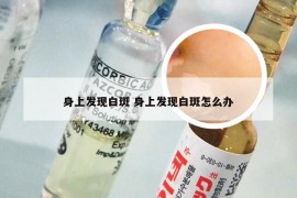 身上发现白斑 身上发现白斑怎么办