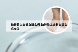 缺锌脸上会长白斑么吗 缺锌脸上会长白斑么吗女生