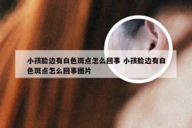 小孩脸边有白色斑点怎么回事 小孩脸边有白色斑点怎么回事图片