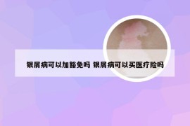 银屑病可以加豁免吗 银屑病可以买医疗险吗