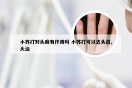 小苏打对头癣有作用吗 小苏打可以去头屑,头油