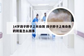 14岁孩子脖子上长白斑 孩子脖子上有白色的斑是怎么回事