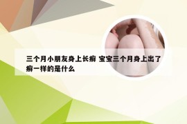 三个月小朋友身上长癣 宝宝三个月身上出了癣一样的是什么