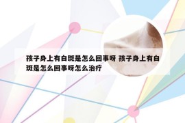 孩子身上有白斑是怎么回事呀 孩子身上有白斑是怎么回事呀怎么治疗