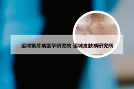 运城银屑病医学研究院 运城皮肤病研究所