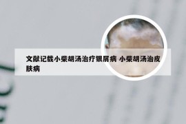 文献记载小柴胡汤治疗银屑病 小柴胡汤治皮肤病