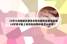 14岁小孩面部长很多白斑去医院说是白斑病 14岁孩子脸上有白色的斑块是怎么回事