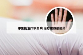 哪里能治疗银血病 治疗银血病的药