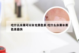 吃什么水果可以补充黑色素 吃什么水果补黑色素最快