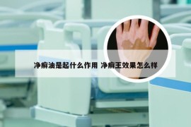 净癣油是起什么作用 净癣王效果怎么样