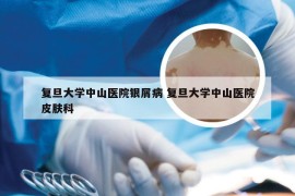 复旦大学中山医院银屑病 复旦大学中山医院皮肤科