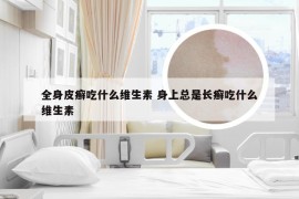 全身皮癣吃什么维生素 身上总是长癣吃什么维生素