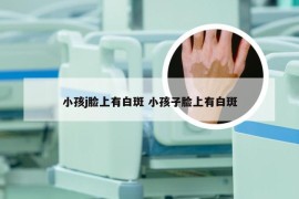 小孩j脸上有白斑 小孩子脸上有白斑