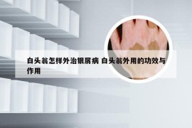 白头翁怎样外治银屑病 白头翁外用的功效与作用