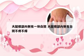 大腿根部内侧有一块白斑 大腿根部内侧有白斑不疼不痒