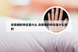 白斑病的特征是什么 白斑病的特征是什么样的