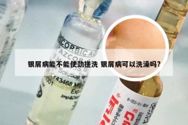 银屑病能不能使劲搓洗 银屑病可以洗澡吗?