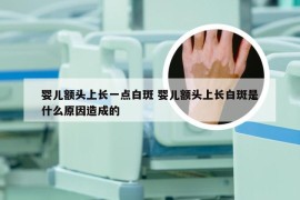 婴儿额头上长一点白斑 婴儿额头上长白斑是什么原因造成的