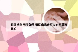 银屑病能用阿奇吗 银屑病患者可以吃阿莫西林吗