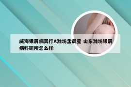 威海银屑病真行A潍坊孟晨星 山东潍坊银屑病科研所怎么样