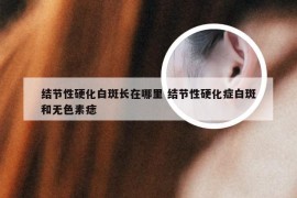 结节性硬化白斑长在哪里 结节性硬化症白斑和无色素痣