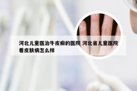 河北儿童医治牛皮癣的医院 河北省儿童医院看皮肤病怎么样