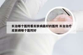 长治哪个医院看皮肤病最好的医院 长治治疗皮肤病哪个医院好