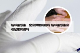 链球菌感染一定会得银屑病吗 链球菌感染会引起银屑病吗