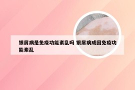 银屑病是免疫功能紊乱吗 银屑病成因免疫功能紊乱