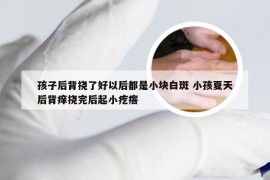 孩子后背挠了好以后都是小块白斑 小孩夏天后背痒挠完后起小疙瘩