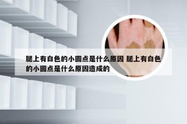 腿上有白色的小圆点是什么原因 腿上有白色的小圆点是什么原因造成的