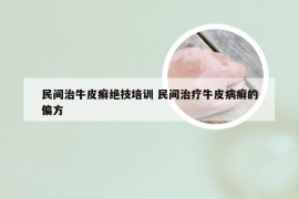 民间治牛皮癣绝技培训 民间治疗牛皮病癣的偏方