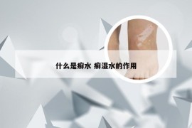 什么是癣水 癣湿水的作用