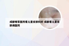 成都哪家医院看儿童皮肤科好 成都看儿童皮肤病医院